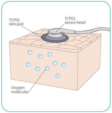 Perfusion test graphic